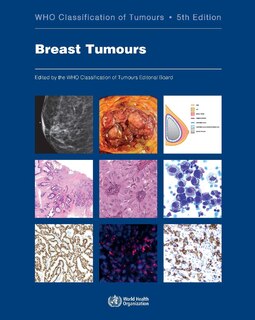 Breast Tumours: Who Classification Of Tumours