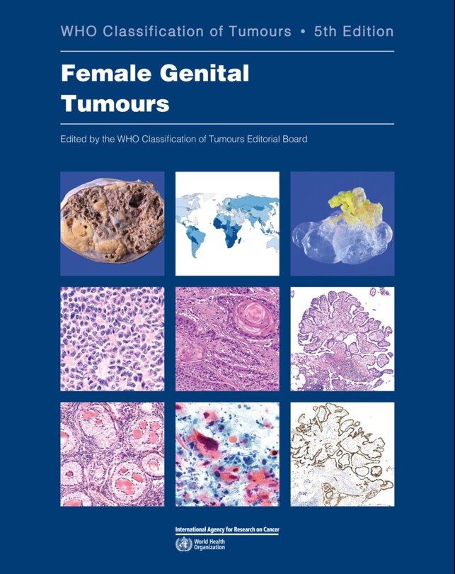 Front cover_Female Genital Tumours