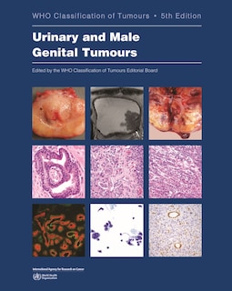 Front cover_Urinary and Male Genital Tumours