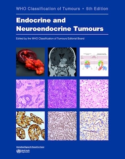 Front cover_Endocrine and Neuroendocrine Tumours