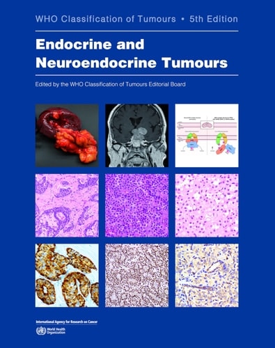 Front cover_Endocrine and Neuroendocrine Tumours