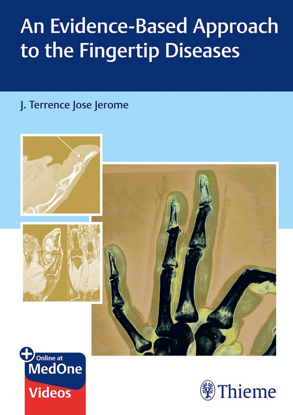 Couverture_An Evidence-Based Approach to the Fingertip Diseases