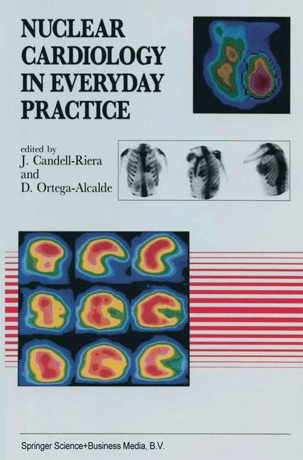 Front cover_Nuclear Cardiology in Everyday Practice