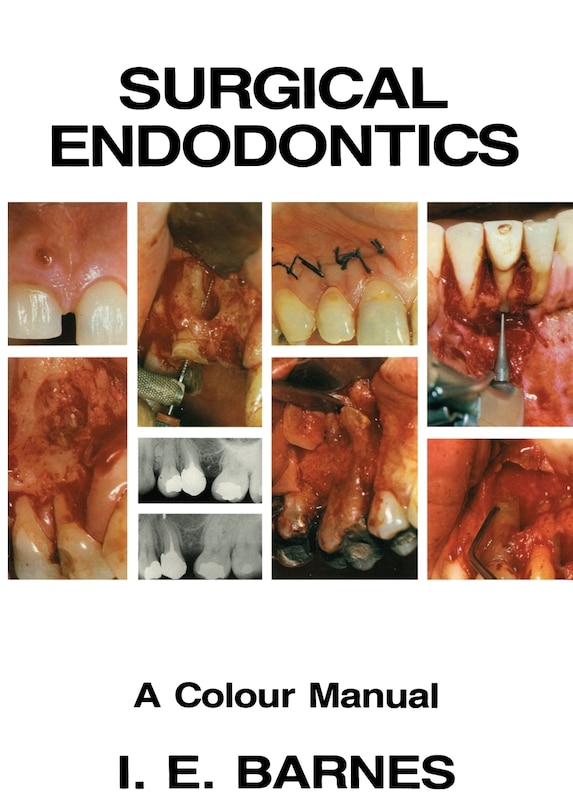 Front cover_Surgical Endodontics