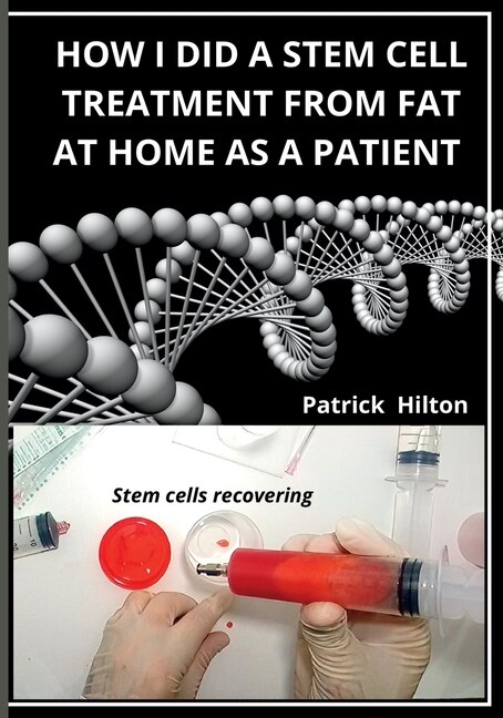 Couverture_How I Did a Stem Cell Treatment From Fat at Home as a Patient