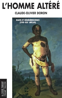 Couverture_L' homme altéré