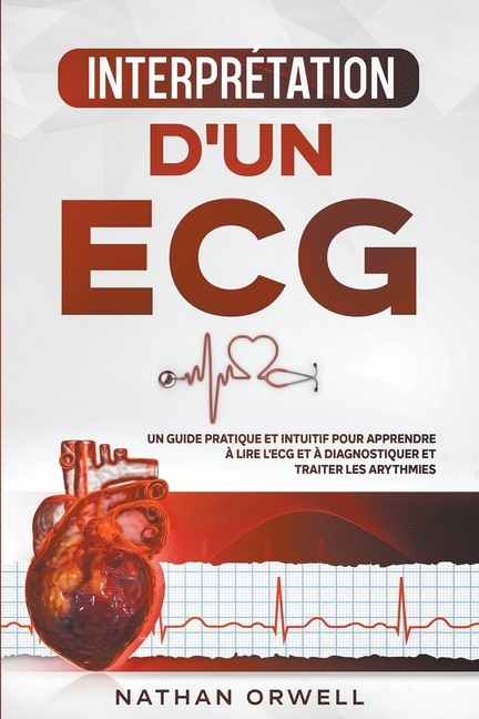 Interprétation d'un ECG: Un Guide Pratique et Intuitif pour Apprendre à Lire un ECG et pour Diagnostiquer et Traiter les Arythmies