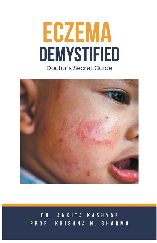 Front cover_Eczema Demystified