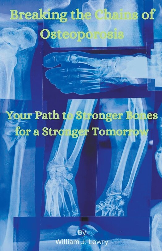 Front cover_Breaking the Chains of Osteoporosis