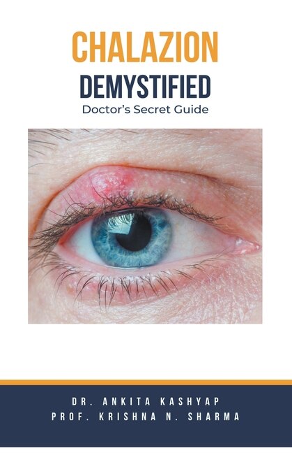 Chalazion Demystified: Doctor's Secret Guide