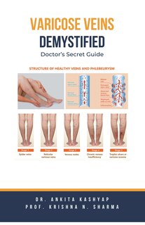 Front cover_Varicose Veins Demystified