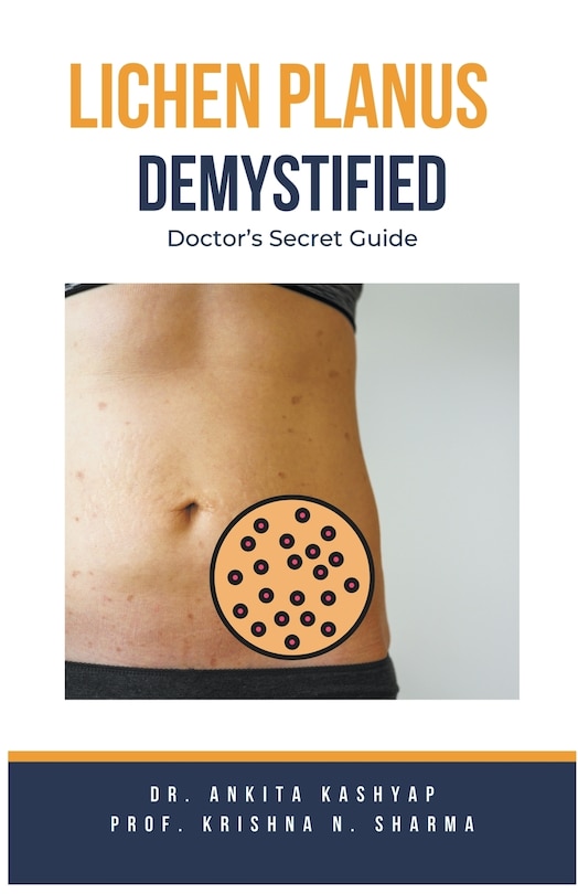 Front cover_Lichen Planus Demystified Doctors Secret Guide
