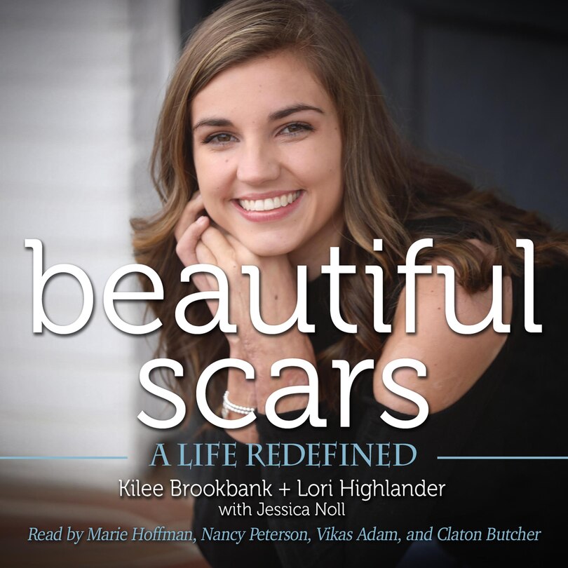 Front cover_Beautiful Scars