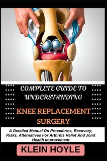 Front cover_Complete Guide to Understanding Knee Replacement Surgery