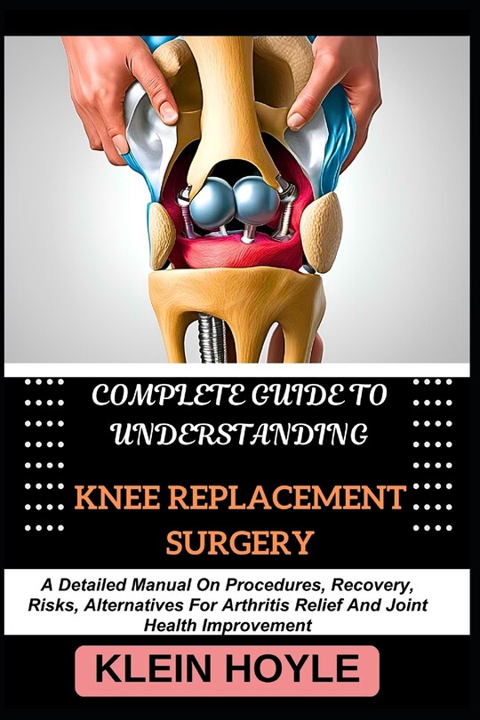Front cover_Complete Guide to Understanding Knee Replacement Surgery