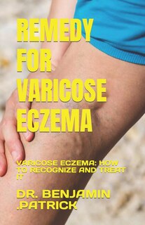 Remedy for Varicose Eczema: Varicose Eczema: How to Recognize and Treat It