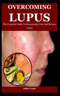 Couverture_Overcoming Lupus