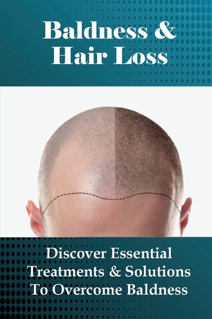 Couverture_Baldness & Hair Loss