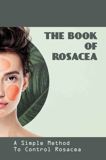 The Book Of Rosacea- A Simple Method To Control Rosacea: Rosacea Treatment For Face