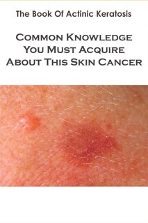 Front cover_The Book Of Actinic Keratosis_ Common Knowledge You Must Acquire About This Skin Cancer
