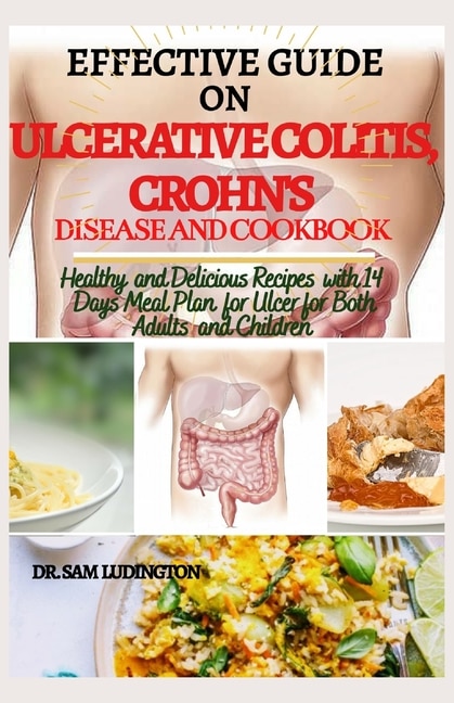 Effective Guide on Ulcerative Colitis, Crohn's Disease and Cookbook: Healthy and Recipes with 14 days meal plan for ulcer for both adults and children