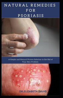 Couverture_Natural Remedies for Psoriasis