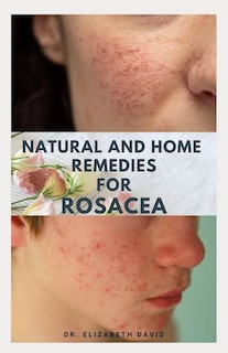 Front cover_Natural and Home Remedies for Rosacea