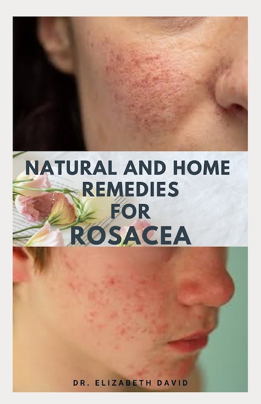 Front cover_Natural and Home Remedies for Rosacea