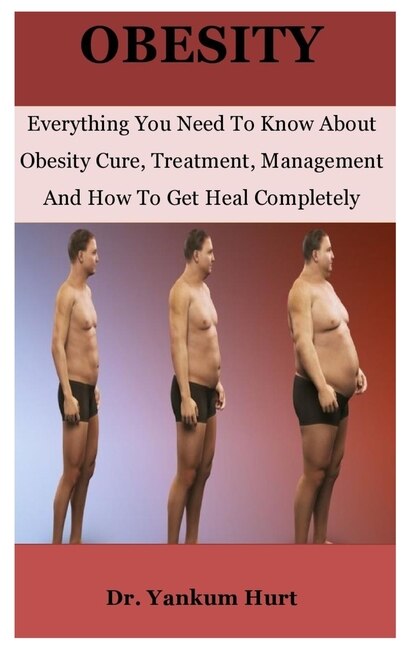 Obesity: Everything You Need To Know About Obesity Cure, Treatment, Management And How To Get Heal Completely