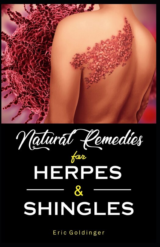 Front cover_Natural Remedies For HERPES & SHINGLES