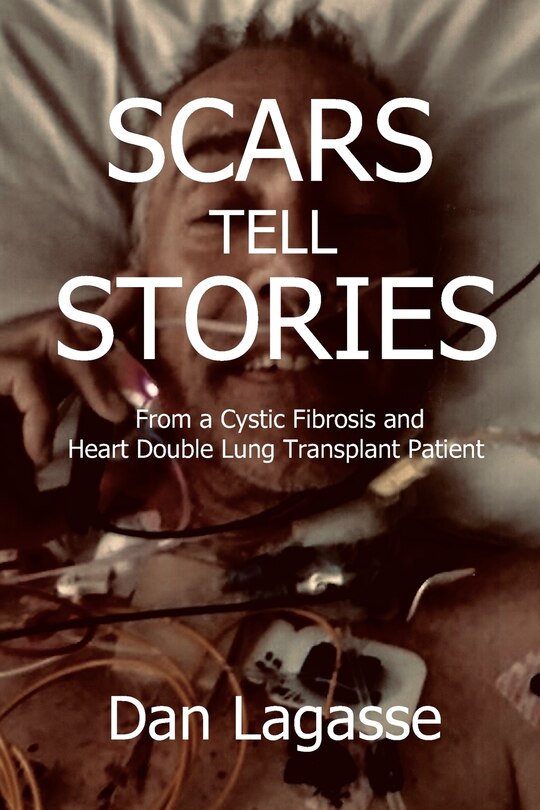 Couverture_Scars Tell Stories