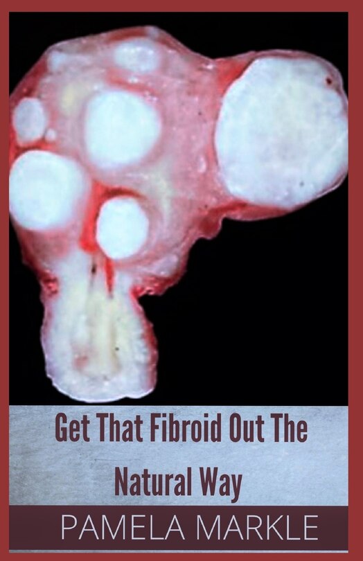 Get That Fibroid Out the Natural Way