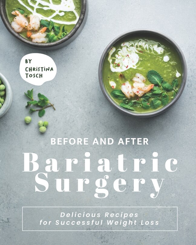 Before and After Bariatric Surgery: Delicious Recipes for Successful Weight Loss