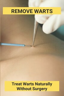 Front cover_Remove Warts