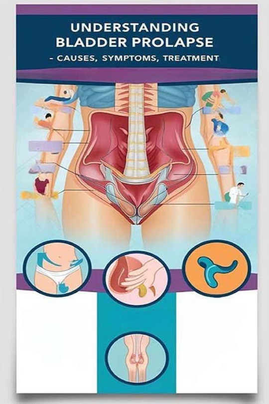 Front cover_Understanding Bladder Prolapse - Causes, Symptoms, Treatment