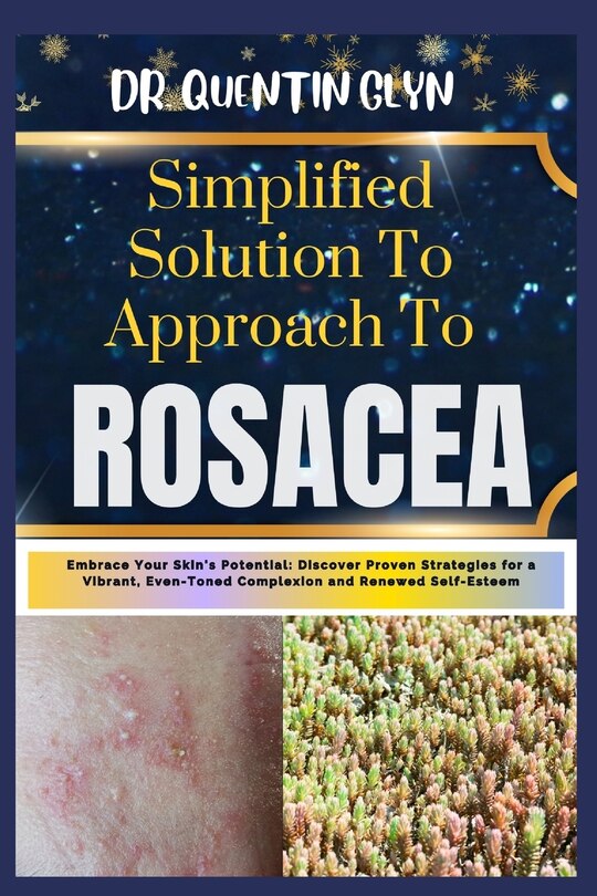 Couverture_Simplified Solution Approach To ROSACEA