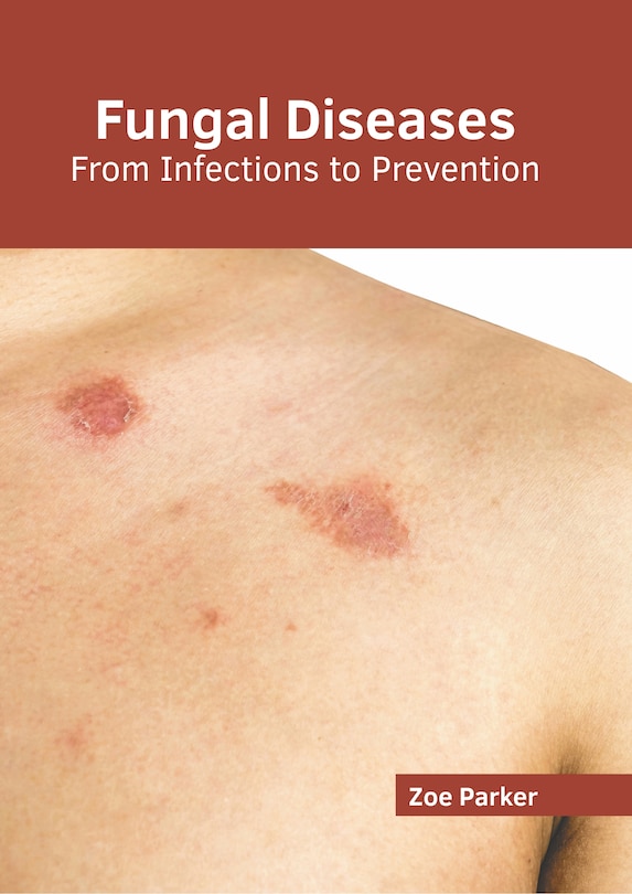 Front cover_Fungal Diseases: From Infections to Prevention