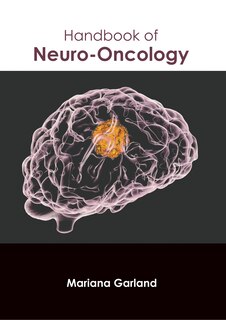 Front cover_Handbook of Neuro-Oncology