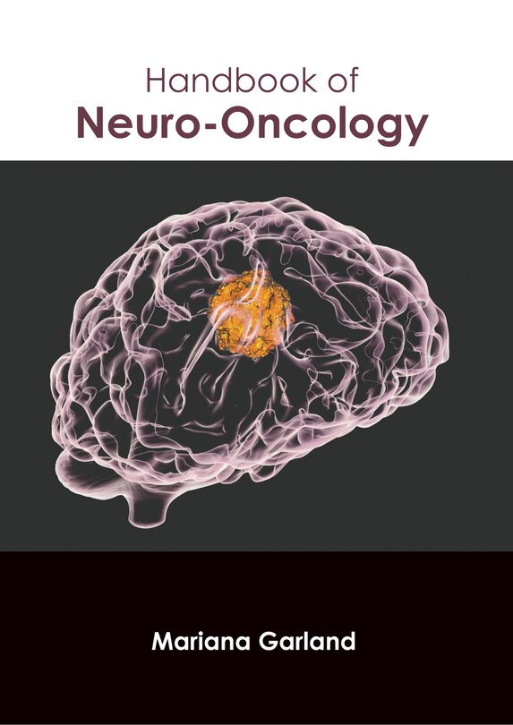 Front cover_Handbook of Neuro-Oncology