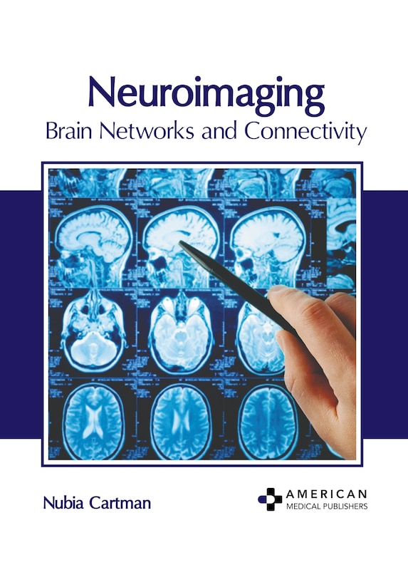 Front cover_Neuroimaging: Brain Networks and Connectivity