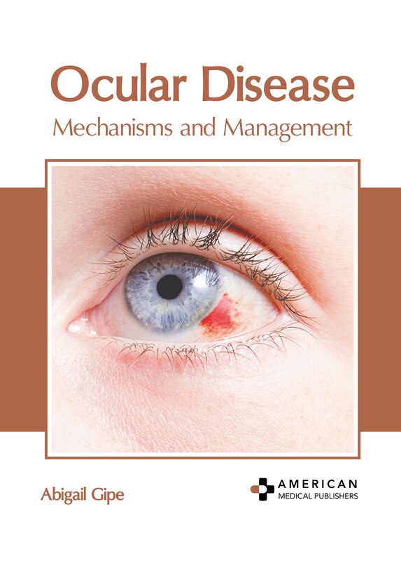 Front cover_Ocular Disease: Mechanisms and Management