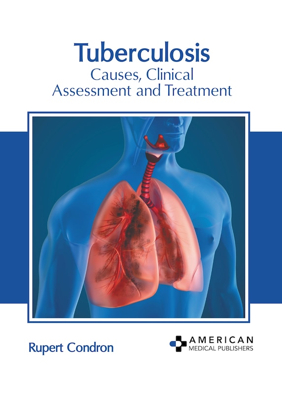 Front cover_Tuberculosis: Causes, Clinical Assessment and Treatment