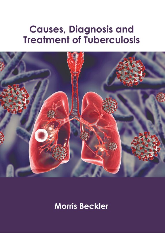 Couverture_Causes, Diagnosis and Treatment of Tuberculosis