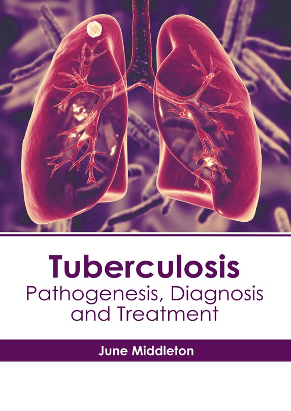 Front cover_Tuberculosis: Pathogenesis, Diagnosis and Treatment