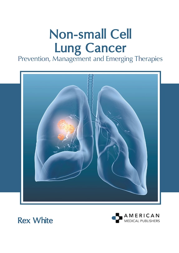 Couverture_Non-small Cell Lung Cancer: Prevention, Management and Emerging Therapies