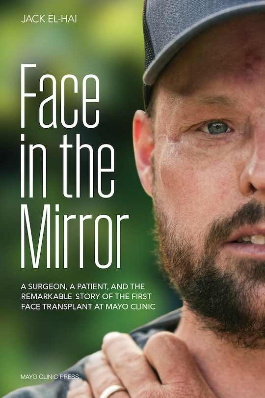 Front cover_Face Transplant