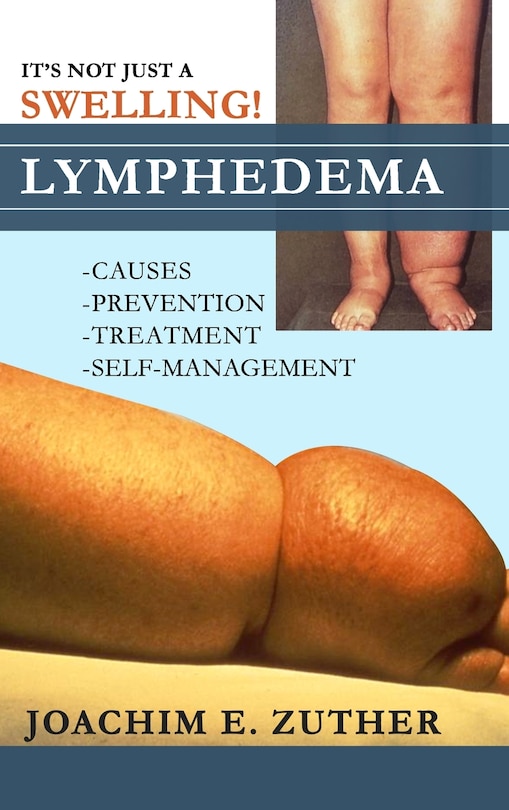 Couverture_It's Not Just a Swelling! Lymphedema