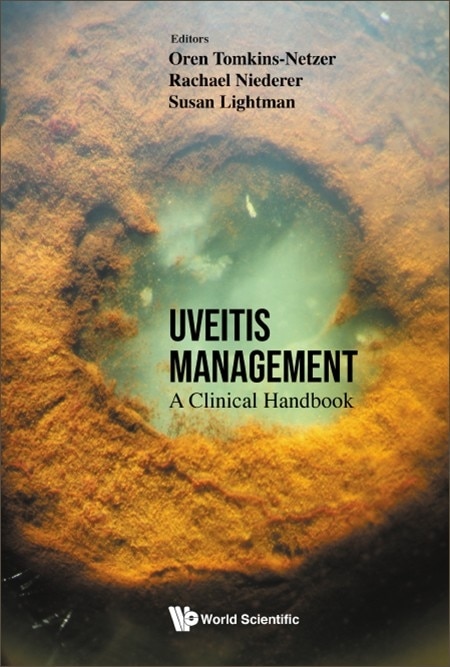 Couverture_Uveitis Management