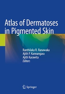 Atlas Of Dermatoses In Pigmented Skin