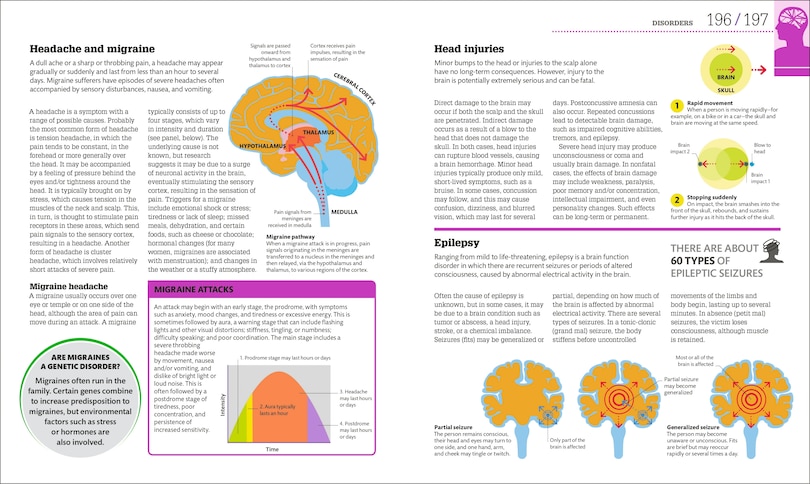 Sample content 3_How The Brain Works